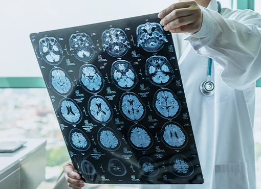 Traumatic Brain Injury Cases 101: Plaintiff, Defense, and Doctor Perspectives